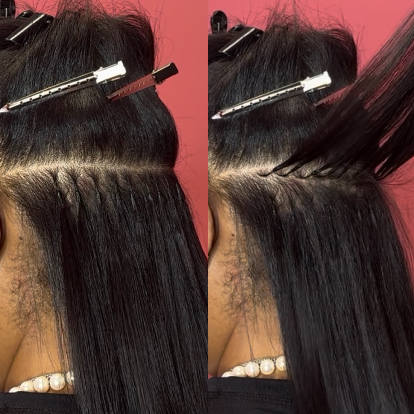 Invisible K-Tip — blended natural movement result
